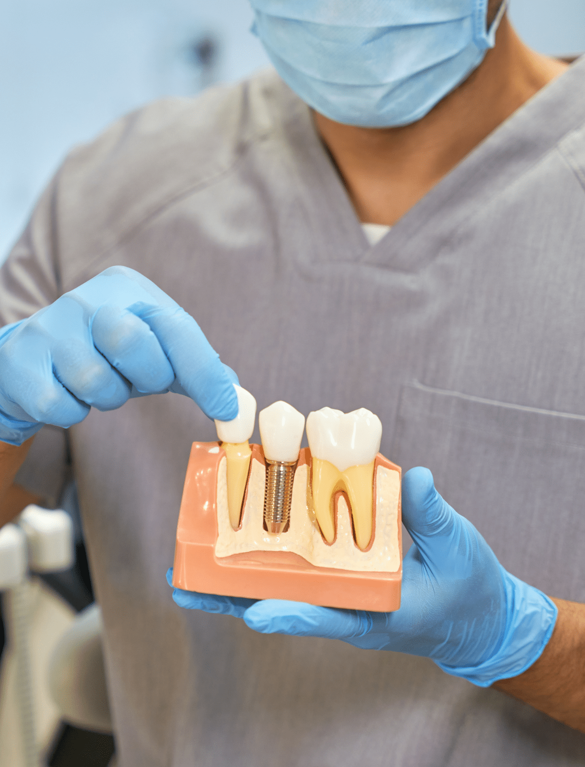 A dentist in Los Feliz demonstrating how dental implants work.<br />